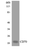 CD27L / CD70 Antibody - Western blot analysis of the lysates from Jurkat cells using CD70 antibody.