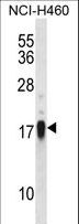 CD27L / CD70 Antibody - CD70 Antibody western blot of NCI-H460 cell line lysates (35 ug/lane). The CD70 antibody detected the CD70 protein (arrow).