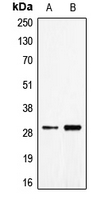 CD27L / CD70 Antibody - Western blot analysis of CD70 expression in Jurkat (A); NCIH460 (B) whole cell lysates.