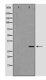 CD27L / CD70 Antibody - Western blot of CD70 expression in COLO205 cells