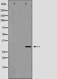 CD27L / CD70 Antibody - Western blot analysis of CD70 expression in COLO205 cells. The lane on the left is treated with the antigen-specific peptide.