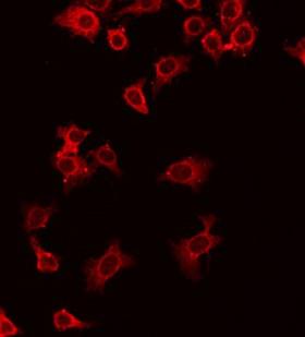 CD27L / CD70 Antibody - Staining HuvEc cells by IF/ICC. The samples were fixed with PFA and permeabilized in 0.1% Triton X-100, then blocked in 10% serum for 45 min at 25°C. The primary antibody was diluted at 1:200 and incubated with the sample for 1 hour at 37°C. An Alexa Fluor 594 conjugated goat anti-rabbit IgG (H+L) Ab, diluted at 1/600, was used as the secondary antibody.