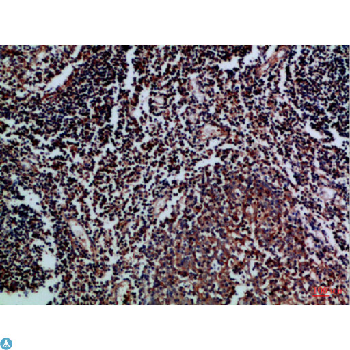 CD27L / CD70 Antibody - Immunohistochemical analysis of paraffin-embedded Human-tonsil, antibody was diluted at 1:100.