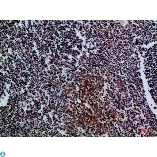 CD27L / CD70 Antibody - Immunohistochemical analysis of paraffin-embedded Human-tonsil, antibody was diluted at 1:100.