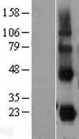 CD27L / CD70 Protein - Western validation with an anti-DDK antibody * L: Control HEK293 lysate R: Over-expression lysate