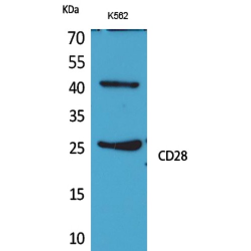 CD28 Antibody - Western blot of CD28 antibody