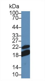 CD28 Antibody - Western Blot; Sample: Mouse Lymph node lysate; Primary Ab: 5µg/ml Rabbit Anti-Mouse CD28 Antibody Second Ab: 0.2µg/mL HRP-Linked Caprine Anti-Rabbit IgG Polyclonal Antibody