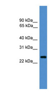CD28 Antibody - CD28 antibody Western blot of Fetal Brain lysate. This image was taken for the unconjugated form of this product. Other forms have not been tested.