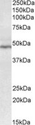 CD28 Antibody - Goat Anti-CD28 Antibody (0.3µg/ml) staining of Human Tonsil lysate (35µg protein in RIPA buffer). Detected by chemiluminescencence.