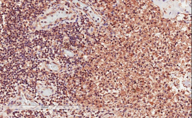 CD28 Antibody - Goat Anti-CD28 Antibody (2µg/ml) staining of paraffin embedded Human Lymph Node. Microwaved antigen retrieval with citrate buffer Ph 6, HRP-staining.