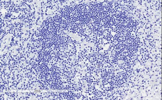 CD28 Antibody - Goat Anti-CD28 Antibody Negative Control showing staining of paraffin embedded Human Lymph Node, with no primary antibody.