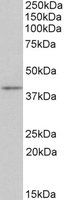 CD28 Antibody - CD28 antibody (0.3 ug/ml) staining of Mouse Thymus lysate (35 ug protein/ml in RIPA buffer). Primary incubation was 1 hour. Detected by chemiluminescence.