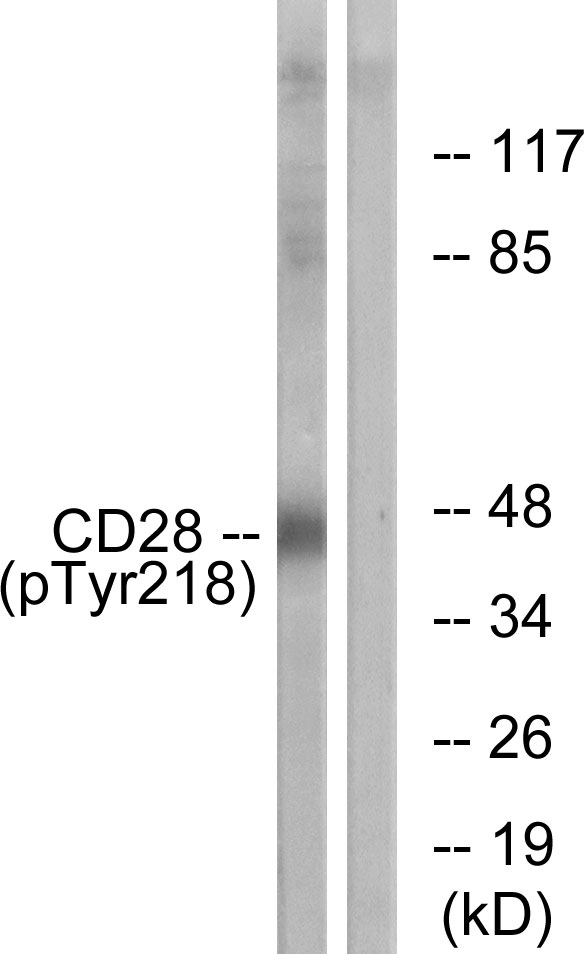 CD28 Antibody - Western blot analysis of lysates from HepG2 cells treated with nocodazole 1ug/ml 16h, using CD28 (Phospho-Tyr218) Antibody. The lane on the right is blocked with the phospho peptide.
