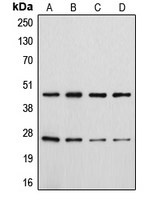 CD28 Antibody - Western blot analysis of CD28 (pY218) expression in HeLa colchicine-treated (A); Jurkat (B); Raw264.7 colchicine-treated (C); H9C2 colchicine-treated (D) whole cell lysates.