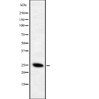 CD28 Antibody - Western blot analysis of Phospho-CD28 (Tyr218) using Jurkat whole cells lysates