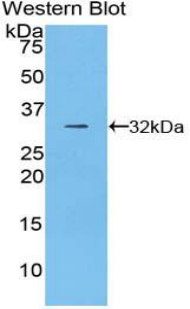 CD2AP Antibody - Western blot of recombinant CD2AP.  This image was taken for the unconjugated form of this product. Other forms have not been tested.