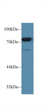CD2AP Antibody - Western Blot; Sample: Rat Testis lysate; Primary Ab: 1µg/ml Rabbit Anti-Rat CD2AP Antibody Second Ab: 0.2µg/mL HRP-Linked Caprine Anti-Rabbit IgG Polyclonal Antibody