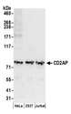 CD2AP Antibody - Detection of human CD2AP by western blot. Samples: Whole cell lysate (50 µg) from HeLa, HEK293T, and Jurkat cells prepared using NETN lysis buffer. Antibodies: Affinity purified rabbit anti-CD2AP antibody used for WB at 0.1 µg/ml. Detection: Chemiluminescence with an exposure time of 30 seconds.