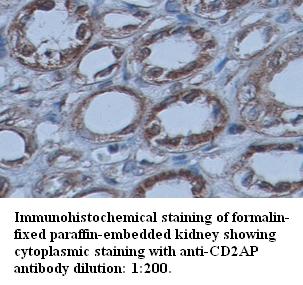 CD2AP Antibody