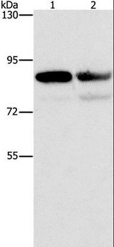 CD2AP Antibody - Western blot analysis of A431 and Raji cell, using CD2AP Polyclonal Antibody at dilution of 1:1000.