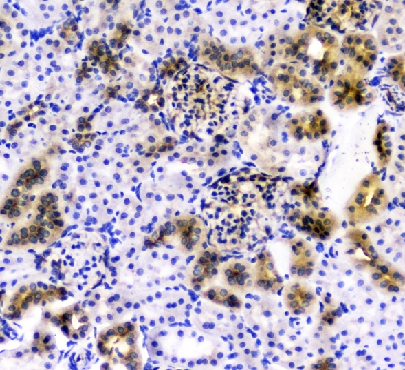 CD2AP Antibody - IHC analysis of CD2AP using anti-CD2AP antibody. CD2AP was detected in paraffin-embedded section of rat kidney tissues. Heat mediated antigen retrieval was performed in citrate buffer (pH6, epitope retrieval solution) for 20 mins. The tissue section was blocked with 10% goat serum. The tissue section was then incubated with 1µg/ml rabbit anti-CD2AP Antibody overnight at 4°C. Biotinylated goat anti-rabbit IgG was used as secondary antibody and incubated for 30 minutes at 37°C. The tissue section was developed using Strepavidin-Biotin-Complex (SABC) with DAB as the chromogen.