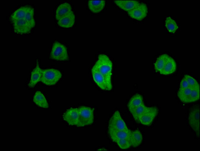 CD2AP Antibody - Immunofluorescence staining of HepG2 cells diluted at 1:66, counter-stained with DAPI. The cells were fixed in 4% formaldehyde, permeabilized using 0.2% Triton X-100 and blocked in 10% normal Goat Serum. The cells were then incubated with the antibody overnight at 4°C.The Secondary antibody was Alexa Fluor 488-congugated AffiniPure Goat Anti-Rabbit IgG (H+L).