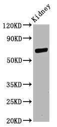 CD2AP Antibody - Western Blot Positive WB detected in: Rat kidney tissue All Lanes: CD2AP antibody at 11µg/ml Secondary Goat polyclonal to rabbit IgG at 1/50000 dilution Predicted band size: 72 KDa Observed band size: 72 KDa