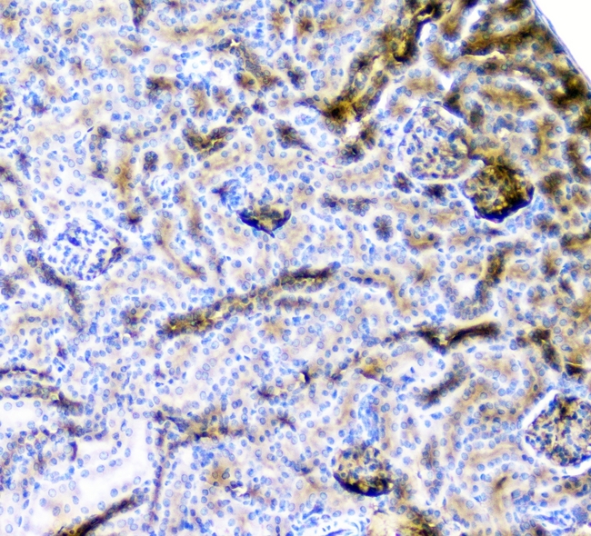 CD2AP Antibody - IHC analysis of CD2AP using anti-CD2AP antibody. CD2AP was detected in paraffin-embedded section of mouse kidney tissue. Heat mediated antigen retrieval was performed in citrate buffer (pH6, epitope retrieval solution) for 20 mins. The tissue section was blocked with 10% goat serum. The tissue section was then incubated with 1µg/ml mouse anti-CD2AP Antibody overnight at 4°C. Biotinylated goat anti-mouse IgG was used as secondary antibody and incubated for 30 minutes at 37°C. The tissue section was developed using Strepavidin-Biotin-Complex (SABC) with DAB as the chromogen.