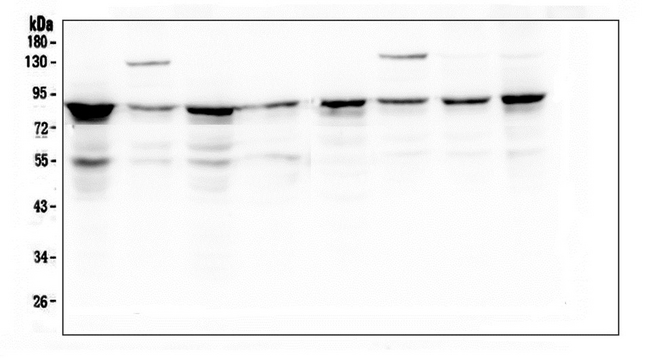 CD2AP Antibody - Western blot analysis of D2AP using anti-D2AP antibody. Electrophoresis was performed on a 5-20% SDS-PAGE gel at 70V (Stacking gel) / 90V (Resolving gel) for 2-3 hours. The sample well of each lane was loaded with 50ug of sample under reducing conditions. Lane 1: human K562 whole cell lysate, Lane 2: human A431 whole cell lysate, Lane 3: human 293T whole cell lysate, Lane 4: human U20S whole cell lysate, Lane 5: human HL-60 whole cell lysate, Lane 6: human MCF-7 whole cell lysate, Lane 7: human Hela whole cell lysate, Lane 8: human PANC-1 whole cell lysate. After Electrophoresis, proteins were transferred to a Nitrocellulose membrane at 150mA for 50-90 minutes. Blocked the membrane with 5% Non-fat Milk/ TBS for 1.5 hour at RT. The membrane was incubated with mouse anti-D2AP antigen affinity purified monoclonal antibody at 0.5 µg/mL overnight at 4°C, then washed with TBS-0.1% Tween 3 times with 5 minutes each and probed with a goat anti-mouse IgG-HRP secondary antibody at a dilution of 1:10000 for 1.5 hour at RT. The signal is developed using an Enhanced Chemiluminescent detection (ECL) kit with Tanon 5200 system.