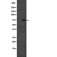 CD2AP Antibody - Western blot analysis of CD2AP expression in HeLa cells lysate. The lane on the left is treated with the antigen-specific peptide.