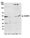 CD2BP2 Antibody - Detection of human and mouse CD2BP2 by western blot. Samples: Whole cell lysate (50 µg) from HeLa, HEK293T, Jurkat, mouse TCMK-1, and mouse NIH 3T3 cells prepared using NETN lysis buffer. Antibody: Affinity purified rabbit anti-CD2BP2 antibody used for WB at 0.4 µg/ml. Detection: Chemiluminescence with an exposure time of 3 minutes.