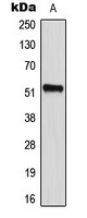 CD2BP2 Antibody - Western blot analysis of CD2BP2 expression in HeLa (A) whole cell lysates.
