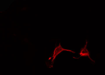 CD2BP2 Antibody - Staining HeLa cells by IF/ICC. The samples were fixed with PFA and permeabilized in 0.1% Triton X-100, then blocked in 10% serum for 45 min at 25°C. The primary antibody was diluted at 1:200 and incubated with the sample for 1 hour at 37°C. An Alexa Fluor 594 conjugated goat anti-rabbit IgG (H+L) antibody, diluted at 1/600, was used as secondary antibody.
