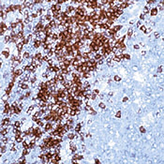 CD3 Antibody - Formalin-fixed, paraffin-embedded human tonsil stained with CD3 antibody.