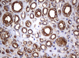 CD30 Antibody - IHC of paraffin-embedded Human Kidney tissue using anti-TNFRSF8 mouse monoclonal antibody.