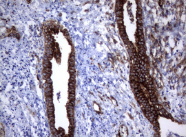 CD30 Antibody - IHC of paraffin-embedded Human endometrium tissue using anti-TNFRSF8 mouse monoclonal antibody.