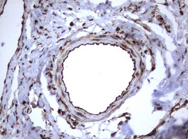 CD30 Antibody - IHC of paraffin-embedded Human lymph node tissue using anti-TNFRSF8 mouse monoclonal antibody.