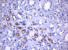 CD30 Antibody - IHC of paraffin-embedded Human Kidney tissue using anti-TNFRSF8 mouse monoclonal antibody.