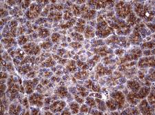 CD30 Antibody - IHC of paraffin-embedded Human pancreas tissue using anti-TNFRSF8 mouse monoclonal antibody.