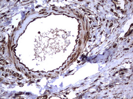 CD30 Antibody - IHC of paraffin-embedded Human lymph node tissue using anti-TNFRSF8 mouse monoclonal antibody.