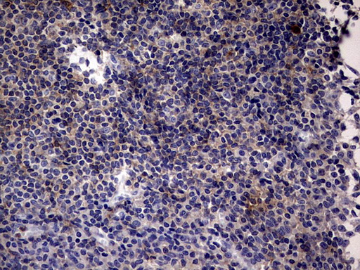 CD30 Antibody - IHC of paraffin-embedded Human tonsil using anti-TNFRSF8 mouse monoclonal antibody. (heat-induced epitope retrieval by 1 mM EDTA in 10mM Tris, pH8.5, 120°C for 3min).