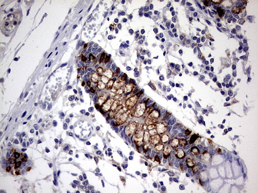 CD30 Antibody - IHC of paraffin-embedded Human colon tissue using anti-TNFRSF8 mouse monoclonal antibody. (heat-induced epitope retrieval by 1 mM EDTA in 10mM Tris, pH8.5, 120°C for 3min).