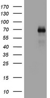 CD30 Antibody - HEK293T cells were transfected with the pCMV6-ENTRY control (Left lane) or pCMV6-ENTRY TNFRSF8 (Right lane) cDNA for 48 hrs and lysed. Equivalent amounts of cell lysates (5 ug per lane) were separated by SDS-PAGE and immunoblotted with anti-TNFRSF8.