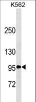 CD30 Antibody - TNFRSF8/CD30 Antibody (Ascites)western blot of K562 cell line lysates (35 ug/lane). The TNFRSF8/CD30 antibody detected the TNFRSF8/CD30 protein (arrow).