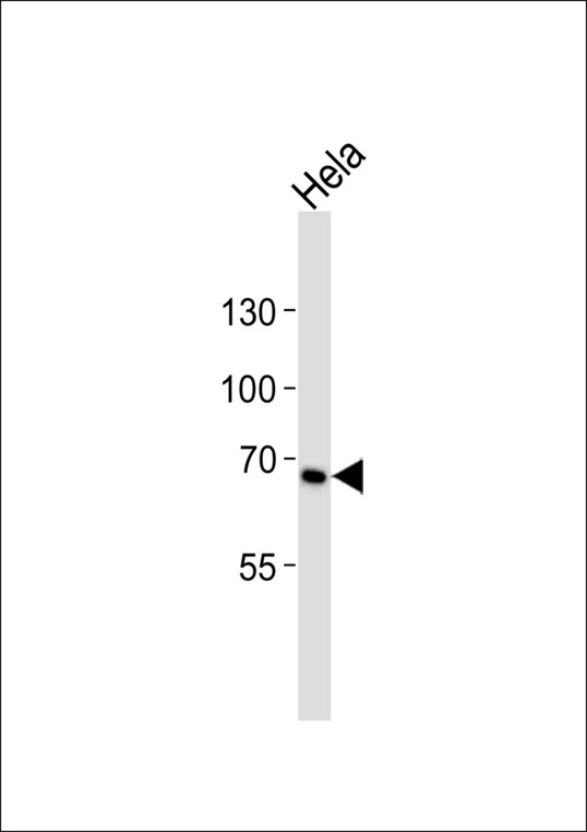 CD30 Antibody - Western blot of lysate from HeLa cell line with TNFRSF8 Antibody. Antibody was diluted at 1:1000. A goat anti-rabbit IgG H&L (HRP) at 1:10000 dilution was used as the secondary antibody. Lysate at 35 ug.