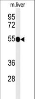 CD30 Antibody - Western blot of TNFRSF8-Y479 in mouse liver tissue lysates (35 ug/lane). TNFRSF8 (arrow) was detected using the purified antibody.