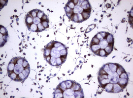 CD30 Antibody - IHC of paraffin-embedded Human colon tissue using anti-TNFRSF8 mouse monoclonal antibody.