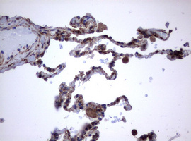 CD30 Antibody - IHC of paraffin-embedded Human lung tissue using anti-TNFRSF8 mouse monoclonal antibody.