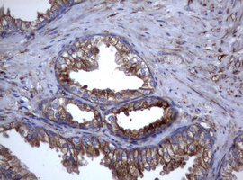 CD30 Antibody - IHC of paraffin-embedded Human prostate tissue using anti-TNFRSF8 mouse monoclonal antibody.