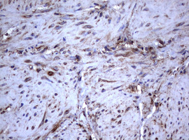 CD30 Antibody - IHC of paraffin-embedded Human bladder tissue using anti-TNFRSF8 mouse monoclonal antibody.